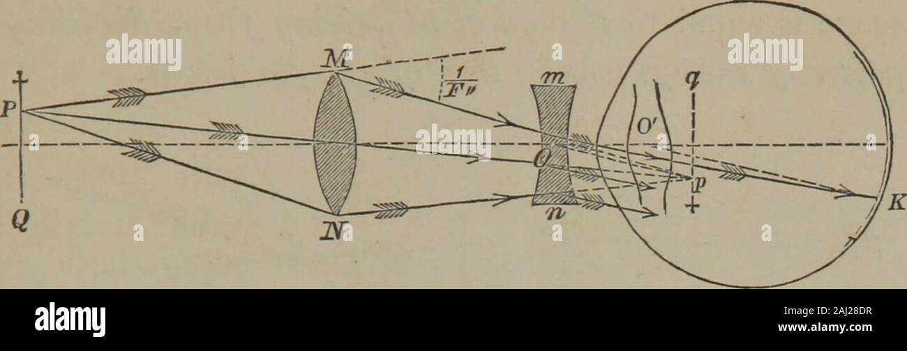 Concave lens invented hires stock photography and images Alamy