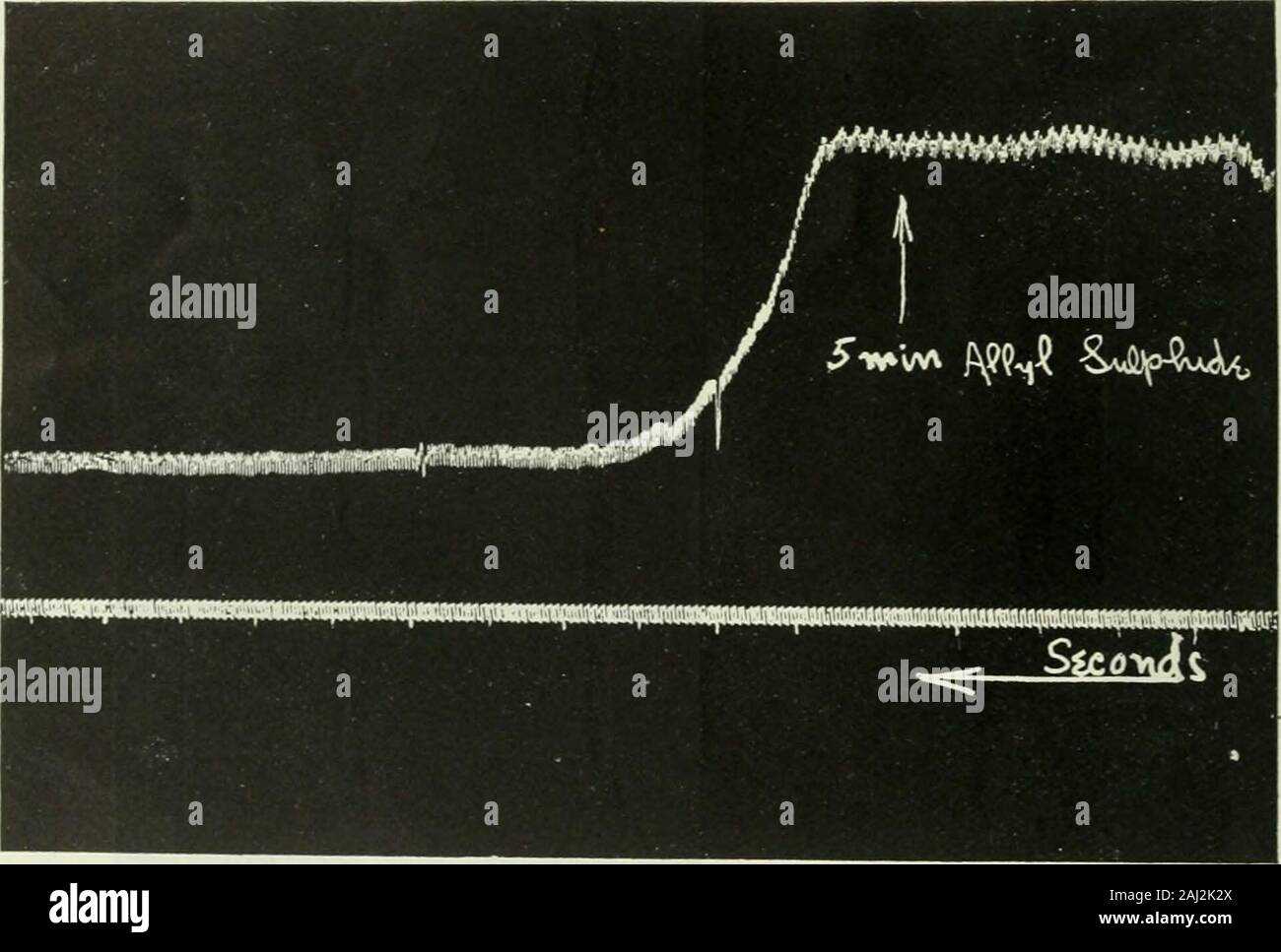 The Biochemical journal, 1907 . I o .. -t3 ^ p Vj b. 334 BIO-CHEMICAL JOURNAL longer time, as may be seen from Fig. 2. No attempt was made torecover the animal from this dose with artificial respiration, Efect of Repeated Small Doses on the Blood Pressure.—The effectof repeated small doses on the same animal is also interesting. In a large rabbit f minim (0*015 ^•^•) ^^ ^^^ ^^^g was injected asabove, and produced on the blood pressure an immediate depressoreffect, rapidly followed by a lesser pressor, which in turn is followedby a fall.. Fig. 2—Carotid trace in a rabbit of 2300 grams showing t Stock Photo