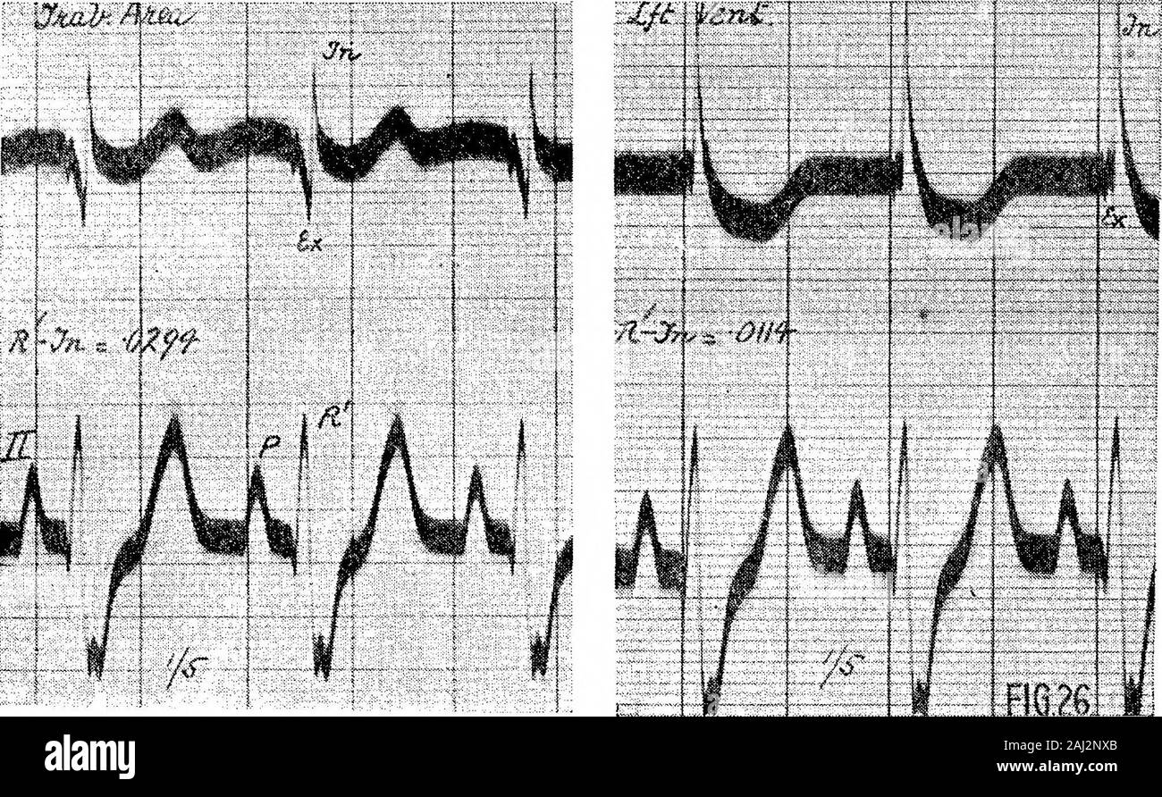 The Excitatory Process in the Dog's Heart Part II The Ventricles