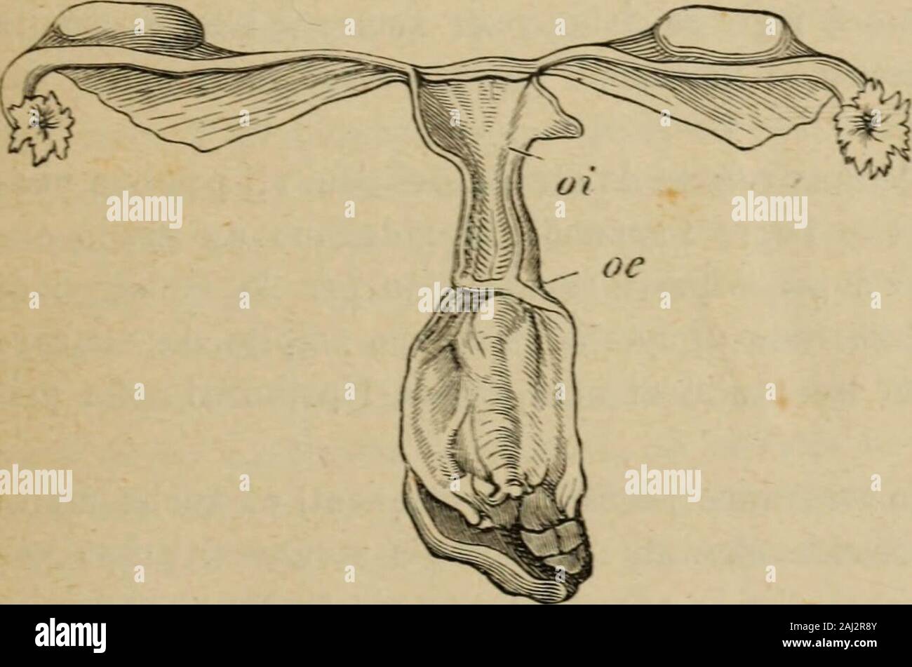 Patologia e terapia delle malattie delle donne ad uso dei medici pratici . ola sutura, e la guarigione seguì senza incidenti. Nella cura consecutiva a queste operazioni sono molto a racco-mandarsi le continue disinfezioni ed, eventualmente, anche luso di irri-gazioni calde per facilitare linvoluzione della cavità. (1) Simon, Beri. Klin. Wochenschrift 1875, n. 20. (2) Amussat, Obs sur une opéraiion de vagin artificiel 1S35. Parigi. II. — ATROFIA DELL UTERO. Di Per prevenir la retrazione cicatriziale Heppner propose di sutu-rare fra loro i lembi dellincisione ai H. — B. Credè ha eseguito iltrapi Stock Photo