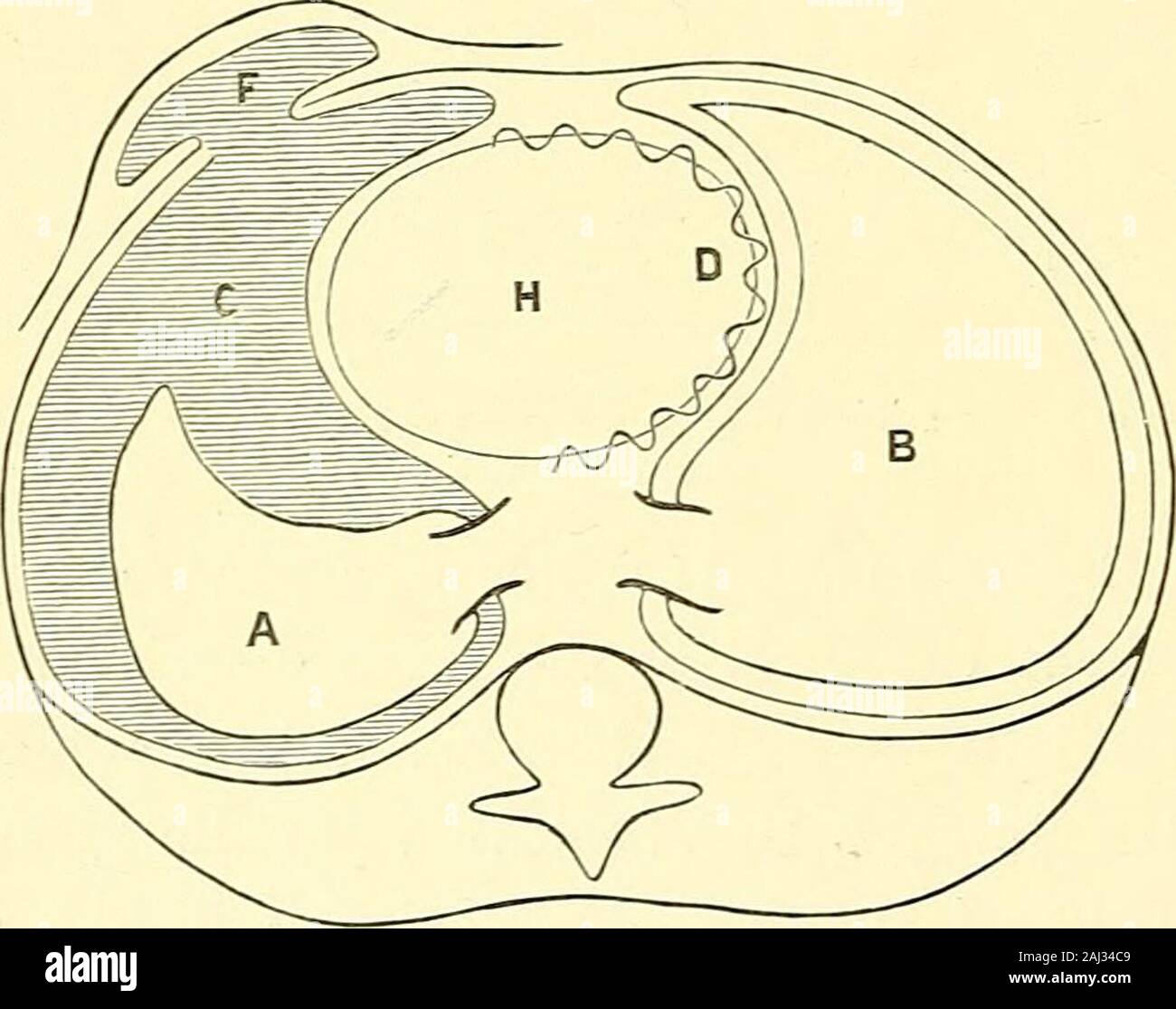Royal Infirmary cliniques . astic air-containing right lung readily yielding to anyenlargement of, or movement of, the heart to the right, andas readily following any diminution of, or movement of, theheart to the left. But now supposing that along the zigzagline D (see Fig. 2) the heart be fixed, by pleuritic, pericardial, 1 LEnvpyenie, Paris, 1888. 2 LEmpyeme Pulsatile, Paris, 1895. 18 PULSATING EMPYE:IA. or mediastinal adhesions, and supposing that the fluid c in the left pleural cavity be in free communication with a subcutaneous abscess cavity F, it is evident that the mechanical conditi Stock Photo