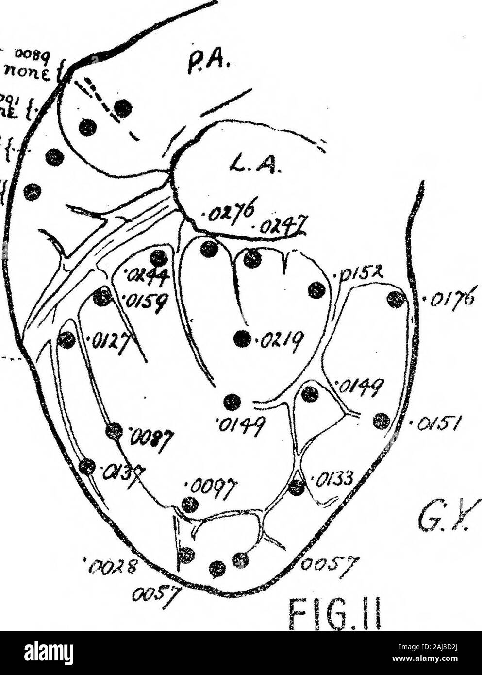 The Excitatory Process in the Dog's Heart Part II The Ventricles . - QOtKJ ?nont i 0X38 V - oamO/f-f JZB.L.. Figs. 6, 7, and 8.—Outlines (f natural size) to scale of the right surface of three dogs hearts (G.T., G.W.,and 6.X.); giving the time-readings of the intrinsic deflections at a number of points. The viewof the heart is not quite the same in the three diagrams. S.Y.C. - superior vena cava; I.V.C. =inferior vena cava; R.A.= right appendix; D.B.E. = descending branch of right coronary artery;D.B.L. = descending branch of left artery; L.Vo. =- vortex of left ventricle. Figs. 9, 10, and 11. Stock Photo