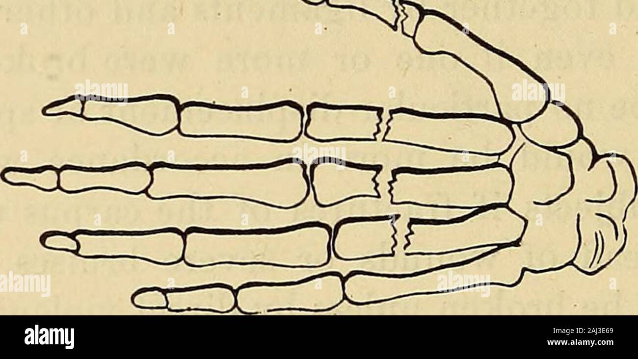 Knuckles Structure A practical and systematic treatise on fractures and dislocations . the ...