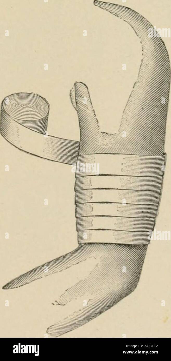 A complete handbook for the sanitary troops of the U S army and navy . Fig. III.— Rapid Spiral. 13 Fig. 112.— Slow Spiral. 194 NURSING Stock Photo