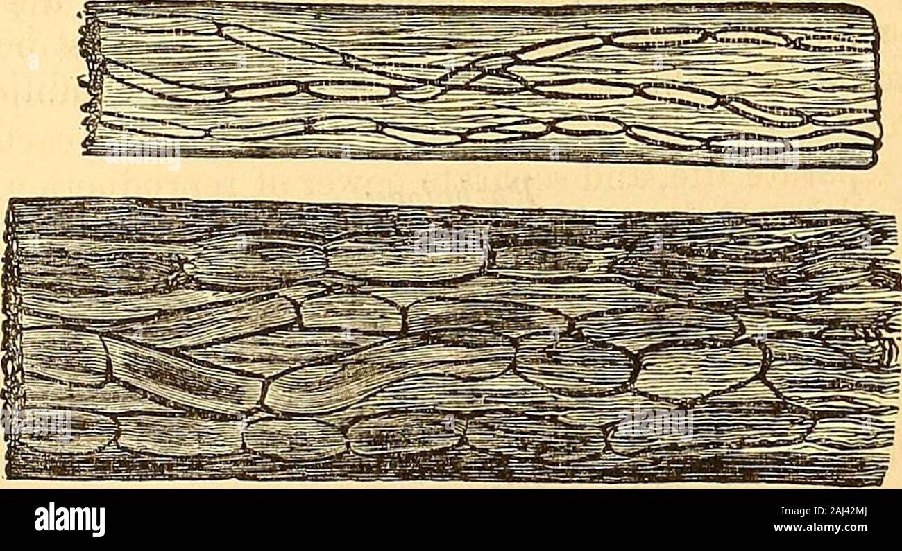 Clinical lectures on the principles and practice of medicine . Fig. 491. Fig. 492. agglomerated in masses are always more abundant and highly developedin the centre of the crust. The thallia, on the other hand, are most nu-merous near the external layer. There may frequently be seen swellingson the sides of the jointed tubes, which are apparently commencing rami-fications. On examining the hairs which pass through the favus crusts, it will. Fig. 493. often be found that they present their healthy structure. At othertimes, however, they evidently contain long jointed branches, similar Fig. 491. Stock Photo