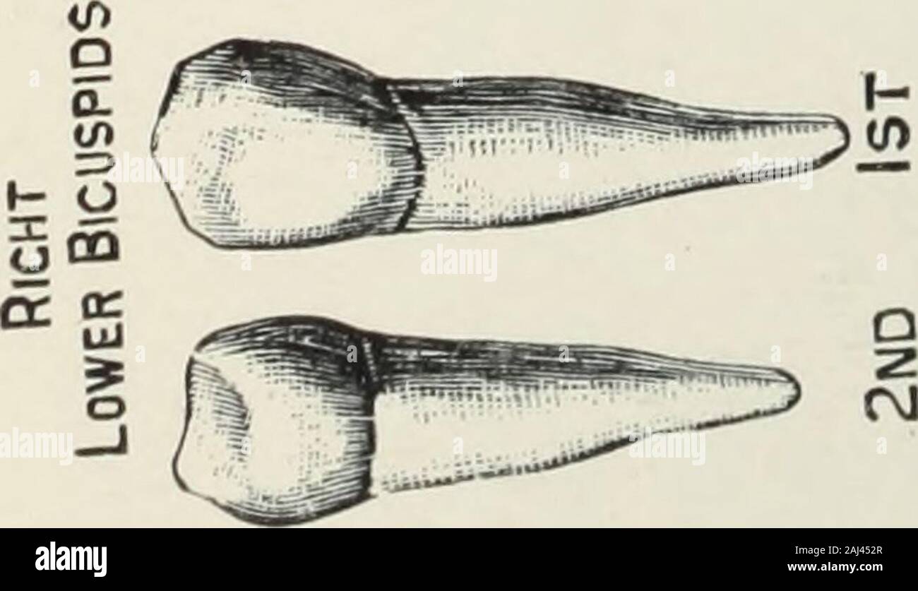 An atlas of dental extractions with notes on the causes and relief of