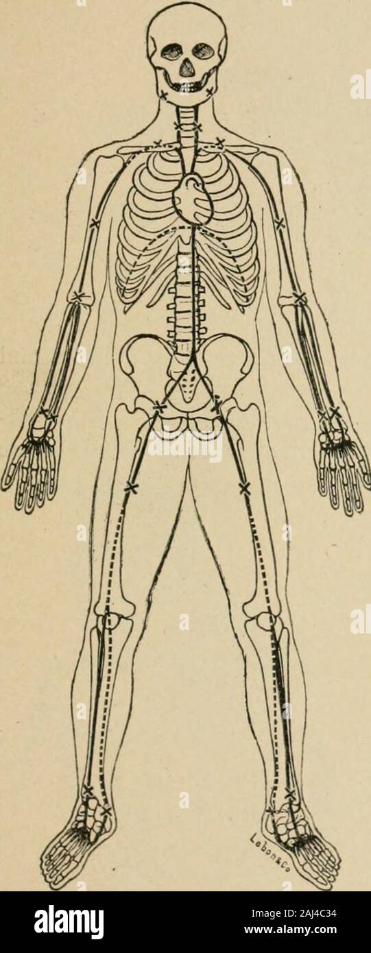 A Complete Handbook For The Sanitary Troops Of The U S Army And Navy Hemorrhages 99 Bleeding Ceases When The Ends Of The Stick Are Tied To The Limb Toprevent The A Complete Handbook For The Sanitary Troops Of The U S Army And Navy Hemorrhages 99 Bleeding Ceases When The Ends Of The Stick Are Tied To The Limb Toprevent The