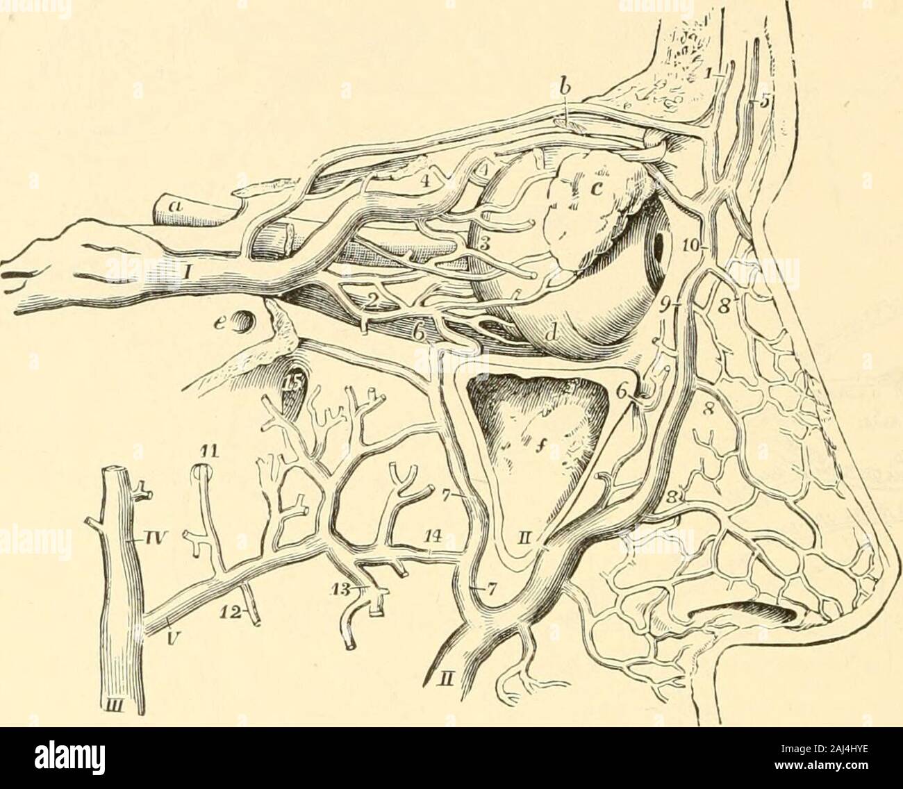 Die Neurologie des Auges Ein Handbuch für Nerven- und Augenärzte . Fig. 144. Schema der intra- und extracraniellen venösen Anastomosen nach Macewen: „Die infektiös-eiterigen Erkrankungen des Gehirns und Kückenmarks, übersetzt von Rudi off, Wiesbaden J. F. Bergmann 1898. 42* 660 Die Stauungspapille bei Sinusthrombose. Leyden (618). Fall 3: 42jähr. Frau mit Hemiplegia sinistra, konjugierter Abweichungder Augen nach rechts, gleichseitiger linksseitiger Hemianopsie mit erhaltener Pupillar-reaktion, beiderseits Stauungspapille, Sektion: Fast vollkommene Thrombose desSinus longitudinalis. Die rechts Stock Photo