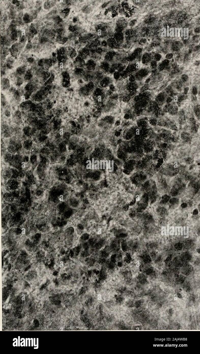 Dense connective tissue hi-res stock photography and images - Alamy