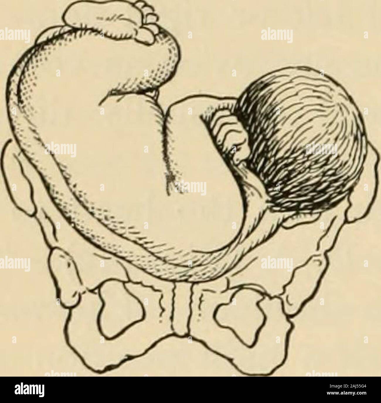 A manual of obstetrics . he right hand, and vice versa.In this first