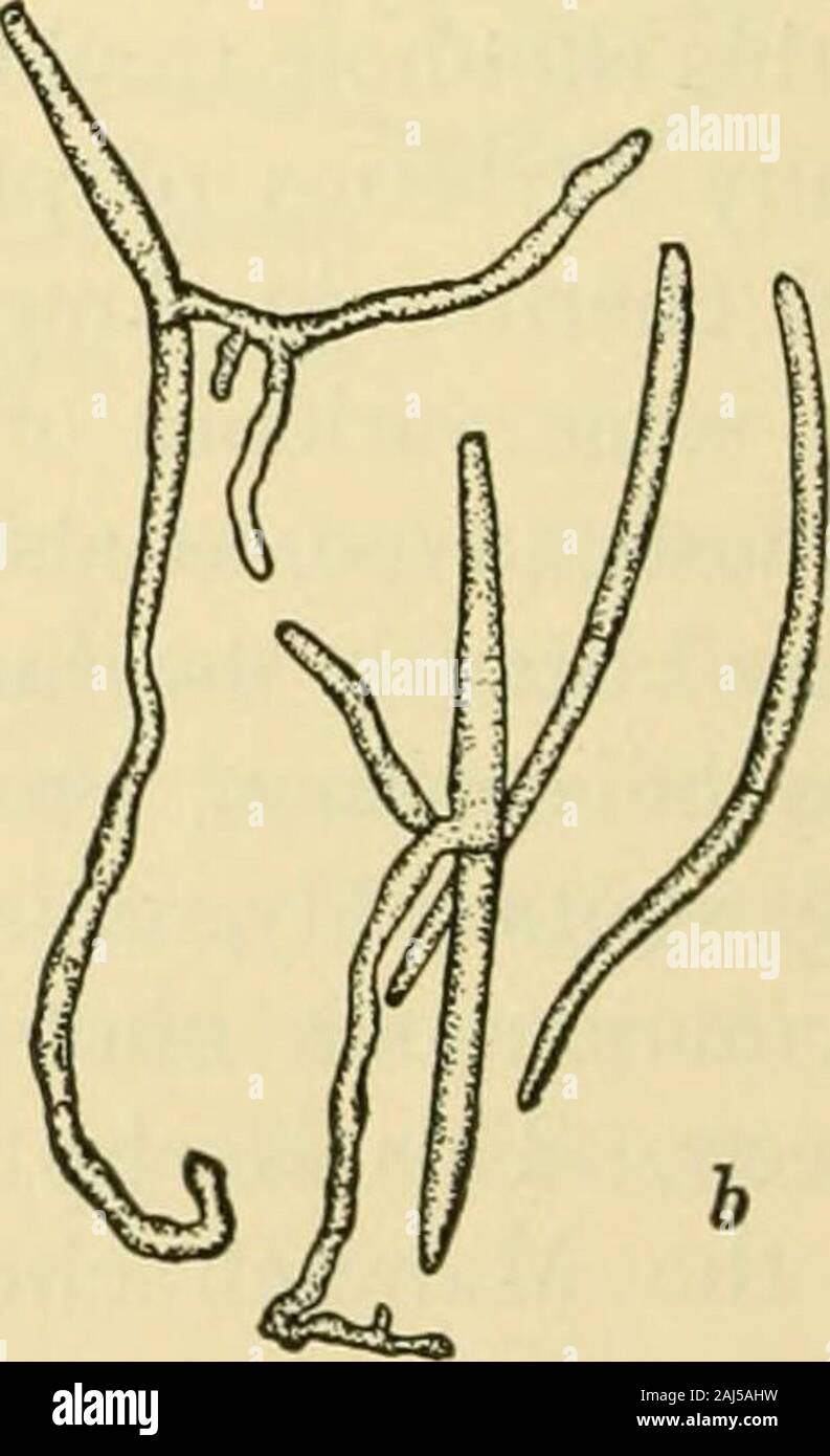 Fungous diseases of plants . Fig. 164. Cylindrosporium Padia, section of acervulus ; 3, conidia, some germinating FUNGI IMPERFECT! 341 48-60 X 2 /i.. They germinate readily, and evidently require but afew days incubation after infection for the production of the char-acteristic shot-holes upon susceptible hosts. No ascogenous stage of this fungus is known, and there is somedoubt as to the ordinary method of wintering over. Stewart, how-ever, has found the pustules of this fungus on the twigs of cherry,and it is quite probable that this is one method of insuring itstransmission from season to s Stock Photo