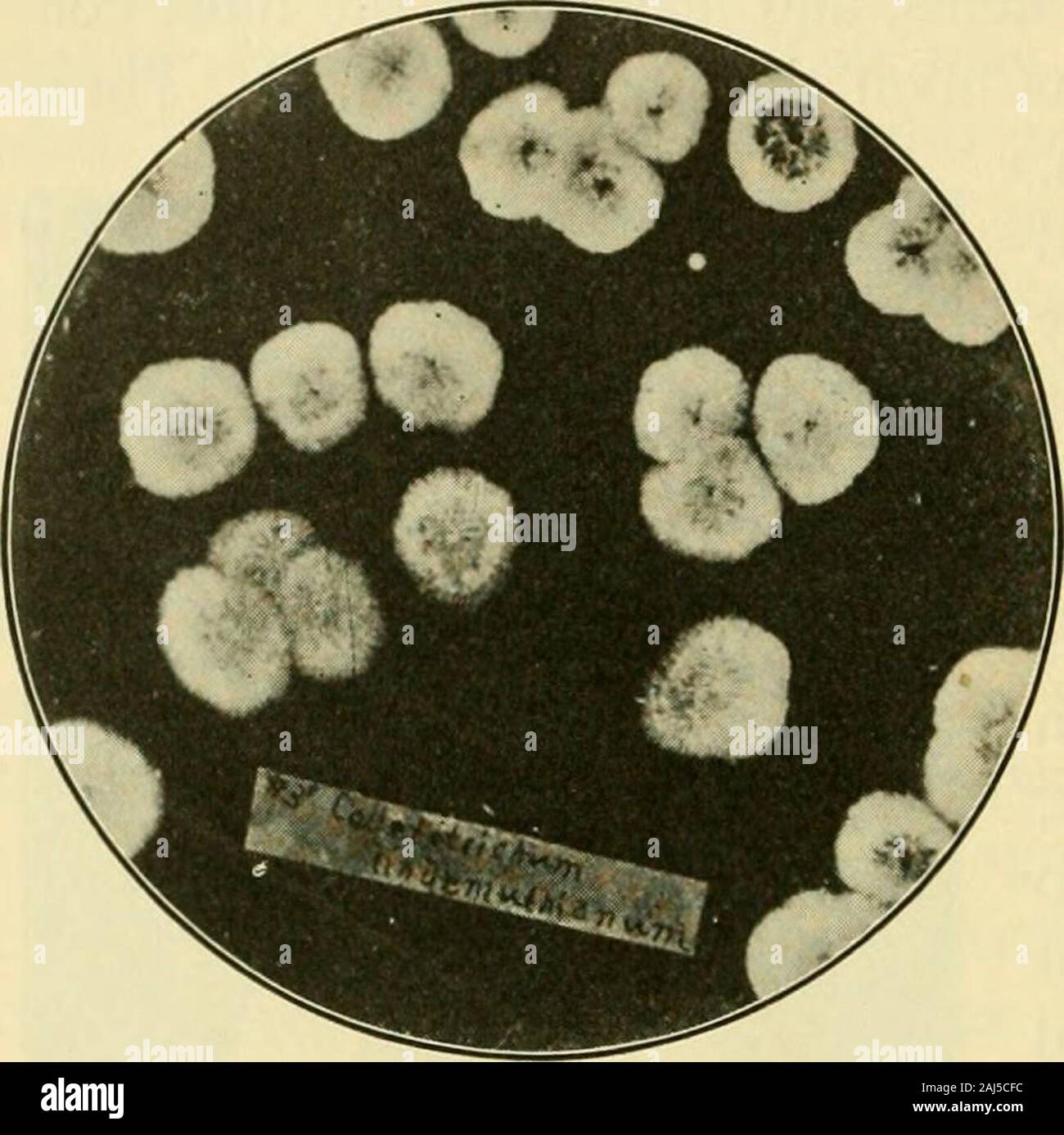 Fungous diseases of plants . Fig. 154. Anthracnose op^ Beans(Photograph by H. H. Whetzel) 324 FUNGOUS DISEASES OF PLANTS. Fig. 155. COLLETOTRICHUM FROM BeAN : AN Isolation Culture. (Photograph byGeo. F. Atkinson) a few dark colored setae are developed.^ The conidia measure15-19 X 3.5-5.5 A*-. They germinate readily and usually become septate during the process.Each conidium is inclosedby a gelatinous envelopewhich when dry glues itto other spores or to anyobject upon which it falls ;when moist, however, thespores are readily sepa-rated and distributed. Control. Very diversemethods of controlli Stock Photo