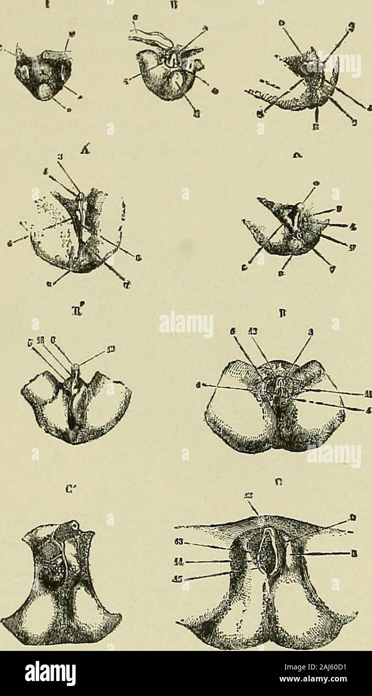 Hermaphroditismus beim Menschen . terhalb dieser Bursaund von ihrem Grunde aus einebindegewebig muskulöse kugel-förmige Erhebung, der Conus in-guinalis, an deren Spitze derHoden mittels des GubernaculumHunteri angelötet ist. Der letzterewird anfänglich durch den gegendie Bauchhöhle vorwachsenden Kegelwieder etwas zurückgeschoben. Baldaber im Verlaufe des 7. Monateskommt es zu einer Umstülpung desConus. Derselbe legt sich demGrunde der Scrotalanlage an undgeht in diesem auf, während derdurch das kurz bleibende Guber-naculum Hunteri am Boden derBursa inguinalis verankerte Ho-den und mit ihm die Stock Photo