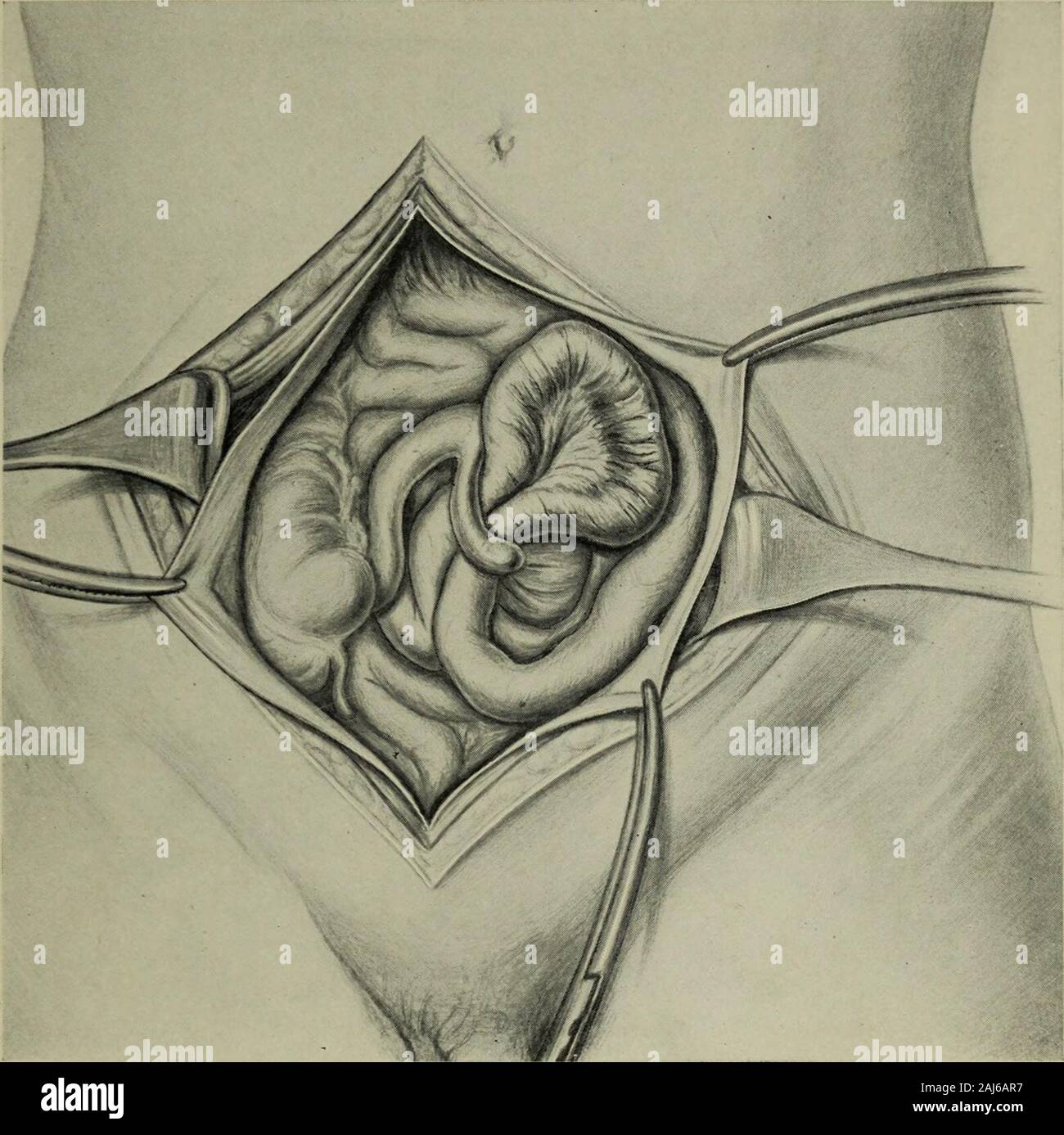 Pulse 70 is that bad Pulse 70 is that bad