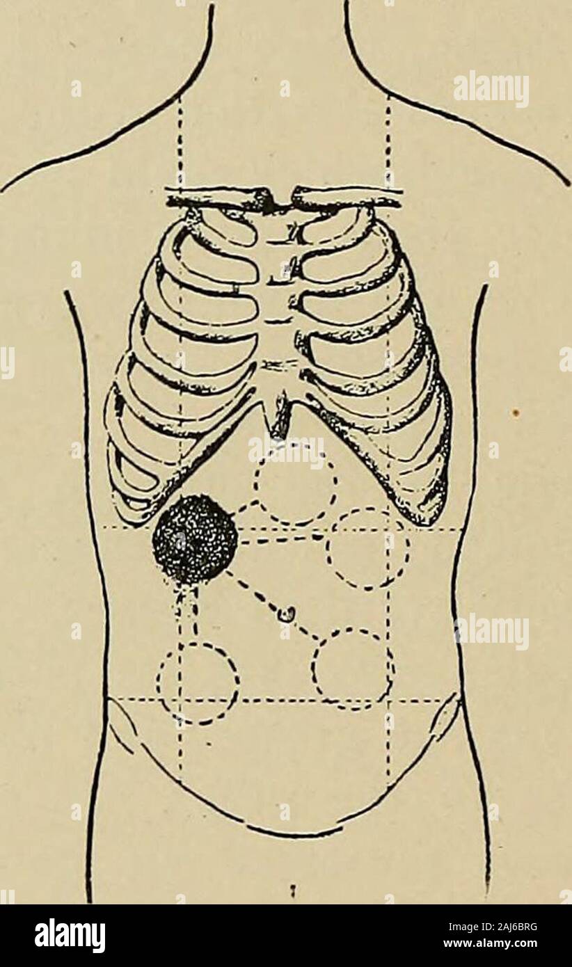 Mass of the right flank.  Download Scientific Diagram