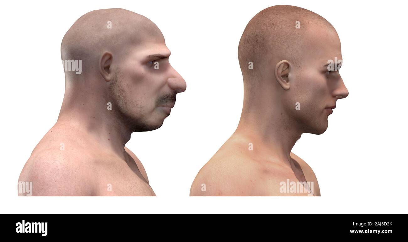 Digital illustration and render of a Neanderthal man Stock Photo - Alamy