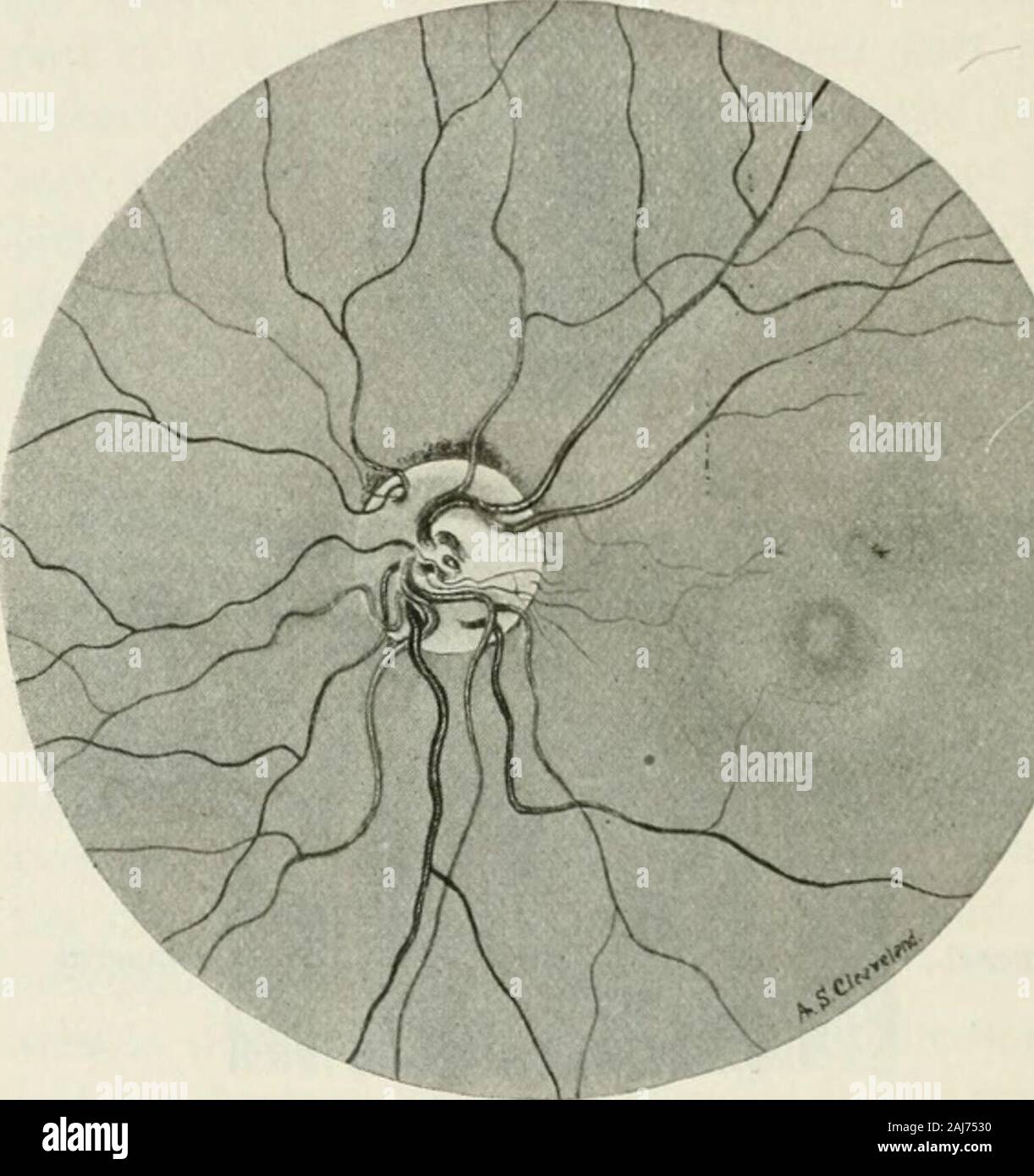 The commoner diseases of the eye how to detect and how to treat them