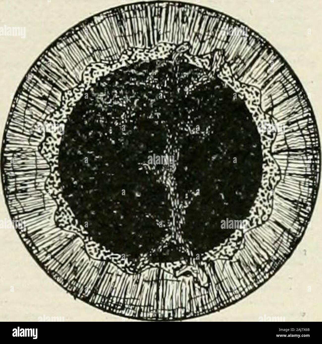 The commoner diseases of the eye : how to detect and how to treat them . Dendritic Ulcer of the Cornea. Herpetic Ulcer is the result of herpes zosterof the ophthalmic division of the fifth nerve,which is often seen with herpes of the face, lipsand nose. Small vesicles occasionally form on thecornea; these, breaking down, are infected andeventually produce ulceration. The disease isaccompanied by severe pain of a neuralgic char-acter. The resulting corneal opacities often in-terfere greatly with useful vision. Malarial Ulcer is sometimes seen in subjectssuffering from malaria. There is loss of Stock Photo