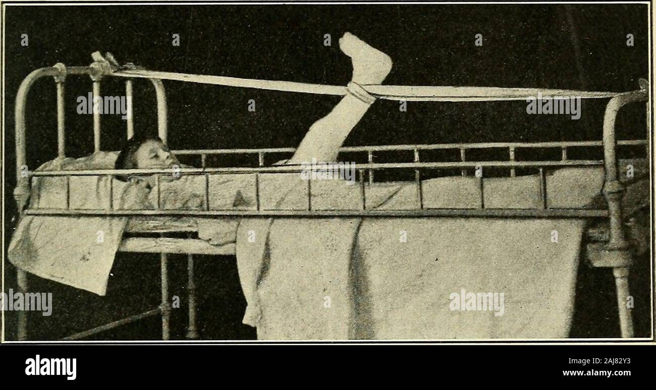 Foot dorsal bones hires stock photography and images Alamy