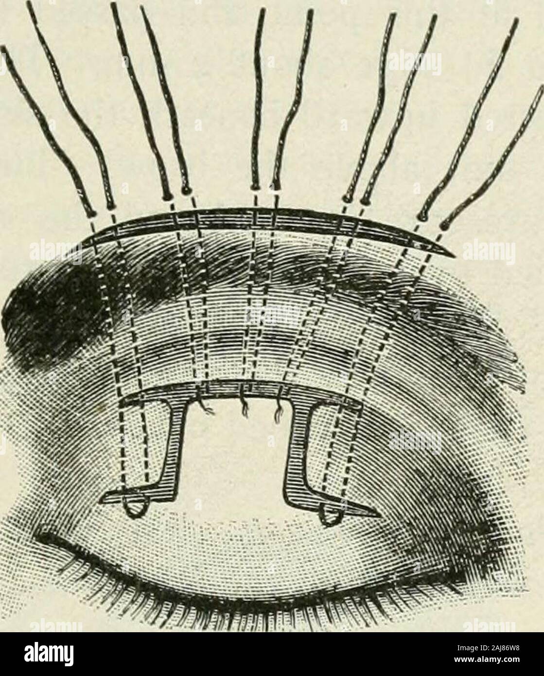 The commoner diseases of the eye : how to detect and how to treat them ...
