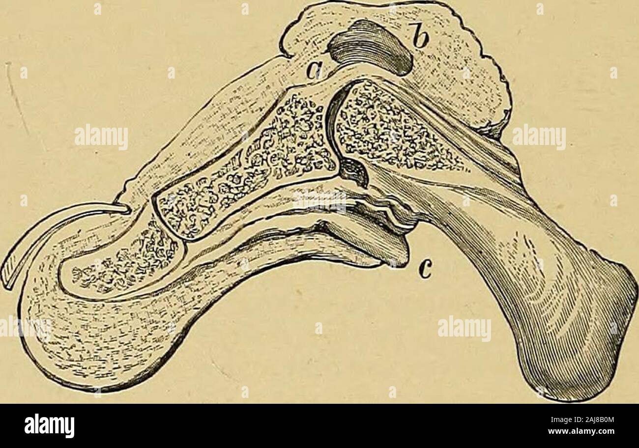Toe Contraction On contractions of the fingers (Dupuytren's and congenital contractions ...