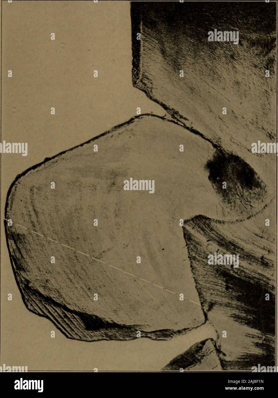 A text-book of dental histology and embryology, including laboratory directions . The region of the carious spot shown in Fig. 107, showing the disintegrated areaof the enamel and the action of acid on the dentine. (About 30 x) AREAS OF WEAKNESS FOR ENAMEL MARGINS 141 Fig. 110. The enamel over the mesial marginal ridge to the oblique groove, showing a regionof weakness for the occlusal wall of a simple proximal cavity. 142 AREAS OF WEAKNESS FOR ENAMEL MARGINS The surface of the enamel from the point directly over thedentine cusp or ridge to the tip of the enamel cusp or ridge,which is an area Stock Photo