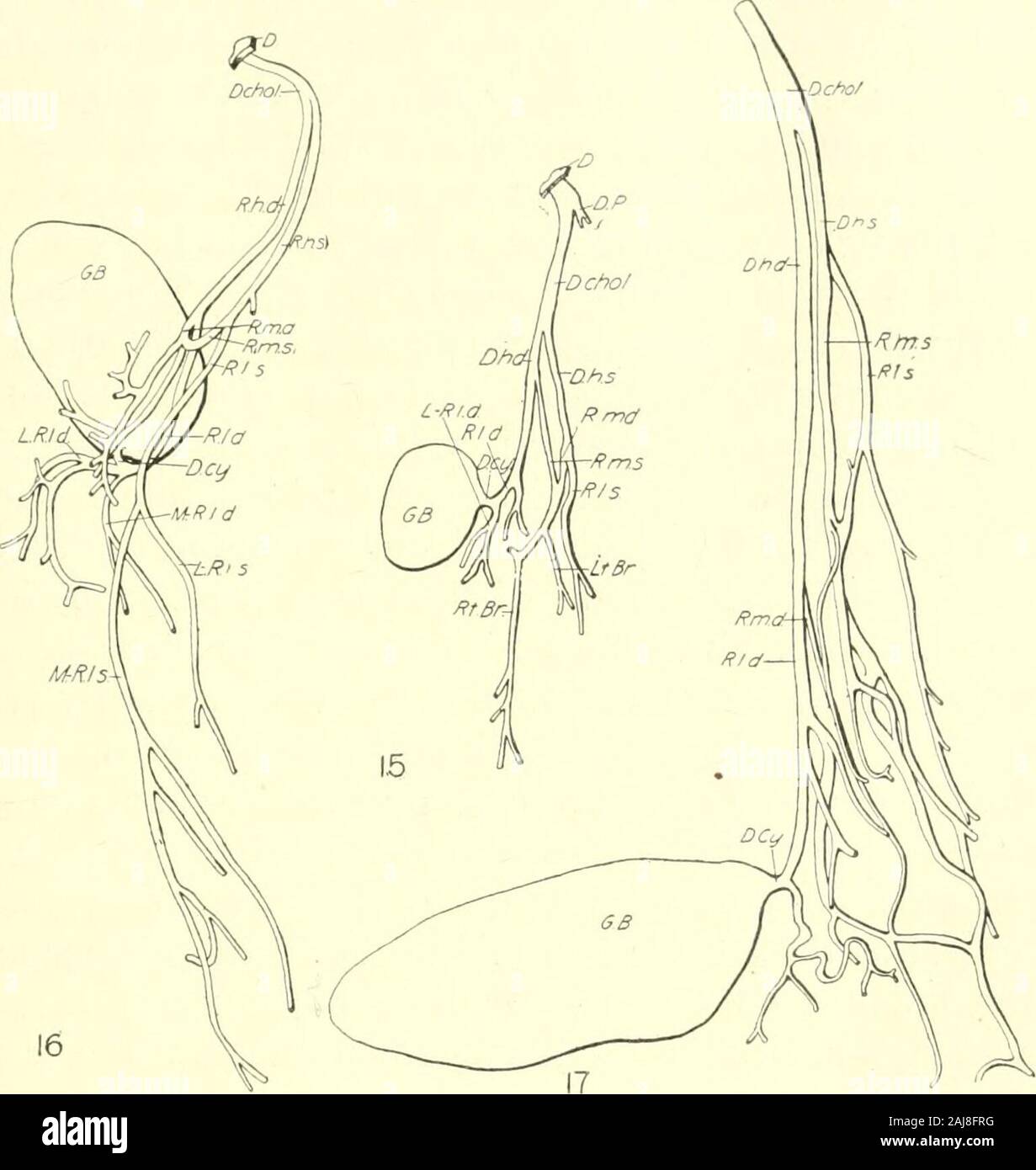 Ductus choledochus hires stock photography and images Alamy