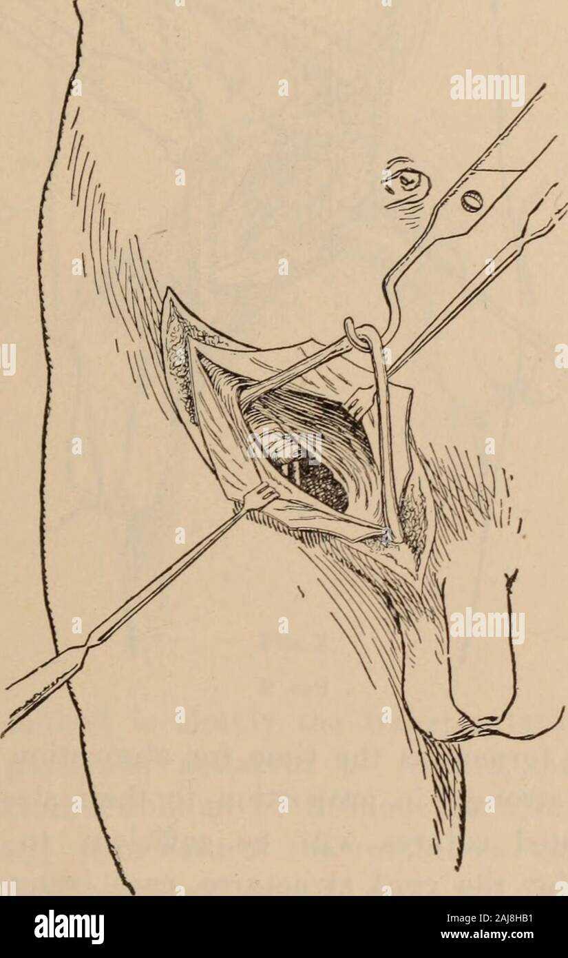 Buffalo medical and surgical journal . loperation anyway, owing to 