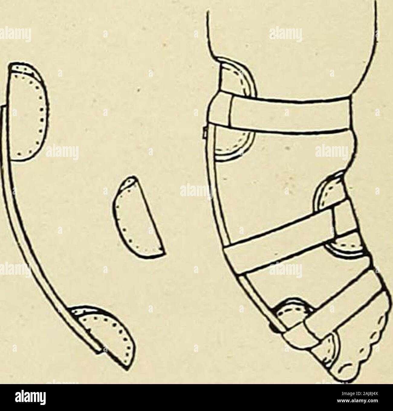 A treatise on orthopedic surgery . The .Judson club-foot splint and its application. may be described in Judsons own words: The apparatuswhich I have conveniently used to effect this reduction beforethe child learns to stand is a simple retentive brace which actsas a lever, making pressure on the outer side of the foot andankle at A, in Figs. 533 to 536, inclusive, and counterpressureat two points, one on the inner side of the leg at B, and theother at the inner Ijorder of the foot at C. It is advisable tokeep in mind that this simple instrument is a lever, because ifwe know that we are using Stock Photo
