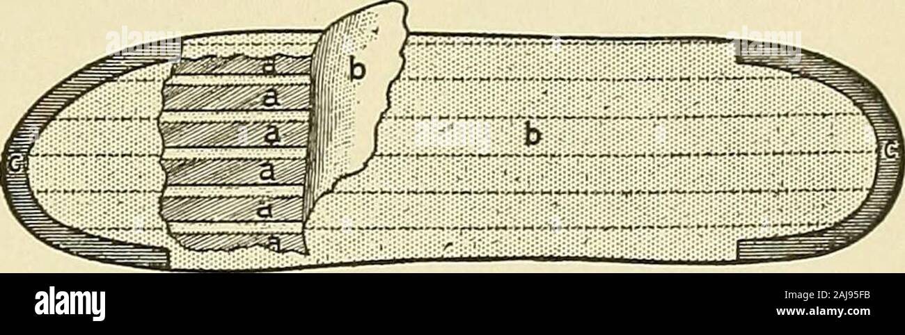 Preparatory and after treatment in operative cases . ARTIFICIAL LIMBS 615. A- A. MARKS, N. Y. Fig. 391.—Spring Mattress for Rubber Foot. the heel. The core is entirely surrounded with rubber of great porositywhich will yield under the weight of the wearer sufficiently to makethe step realistic. Less rubber is placed at the ball so as to providephalangeal support and create a supporting medium at the front ofthe foot, ample to steady him when standing, and to act as a leverwhen walking. A spring mattress is floated in the foot below thecore, covering the entire distance from the back of the hee Stock Photo