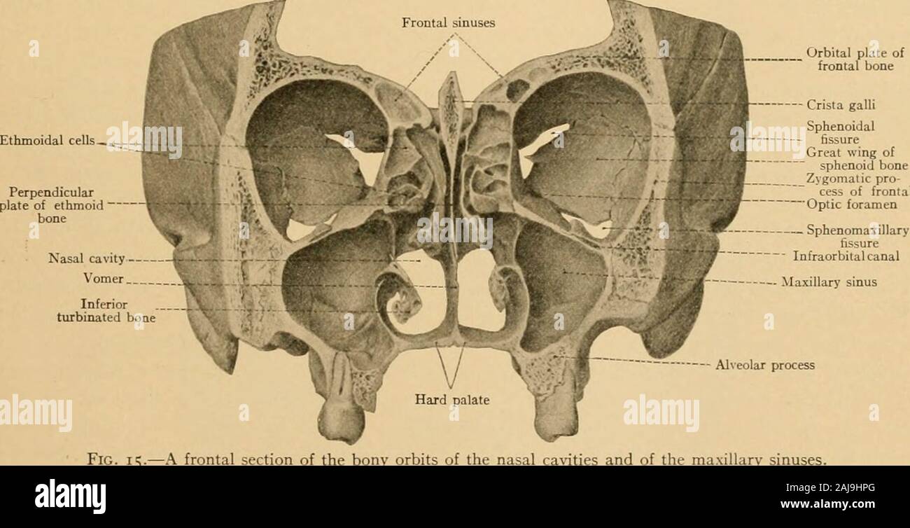 Atlas and text-book of topographic and applied anatomy . L CAVITY. 43 [The bony roof of this canal is usually deficient behind.—Ed.] The external portion of the lowerwall is formed anteriorly by the orbital process of the malar bone; the orbital process of thepalate bone also aids in forming the most posterior portion of the floor. The outer wall consists anteriorly of the orbital process of the malar bone, posteriorly of theorbital surface of the great wing of the sphenoid, and above and anteriorly of the zygomatic(external angular) process of the frontal bone. This surface presents the small Stock Photo