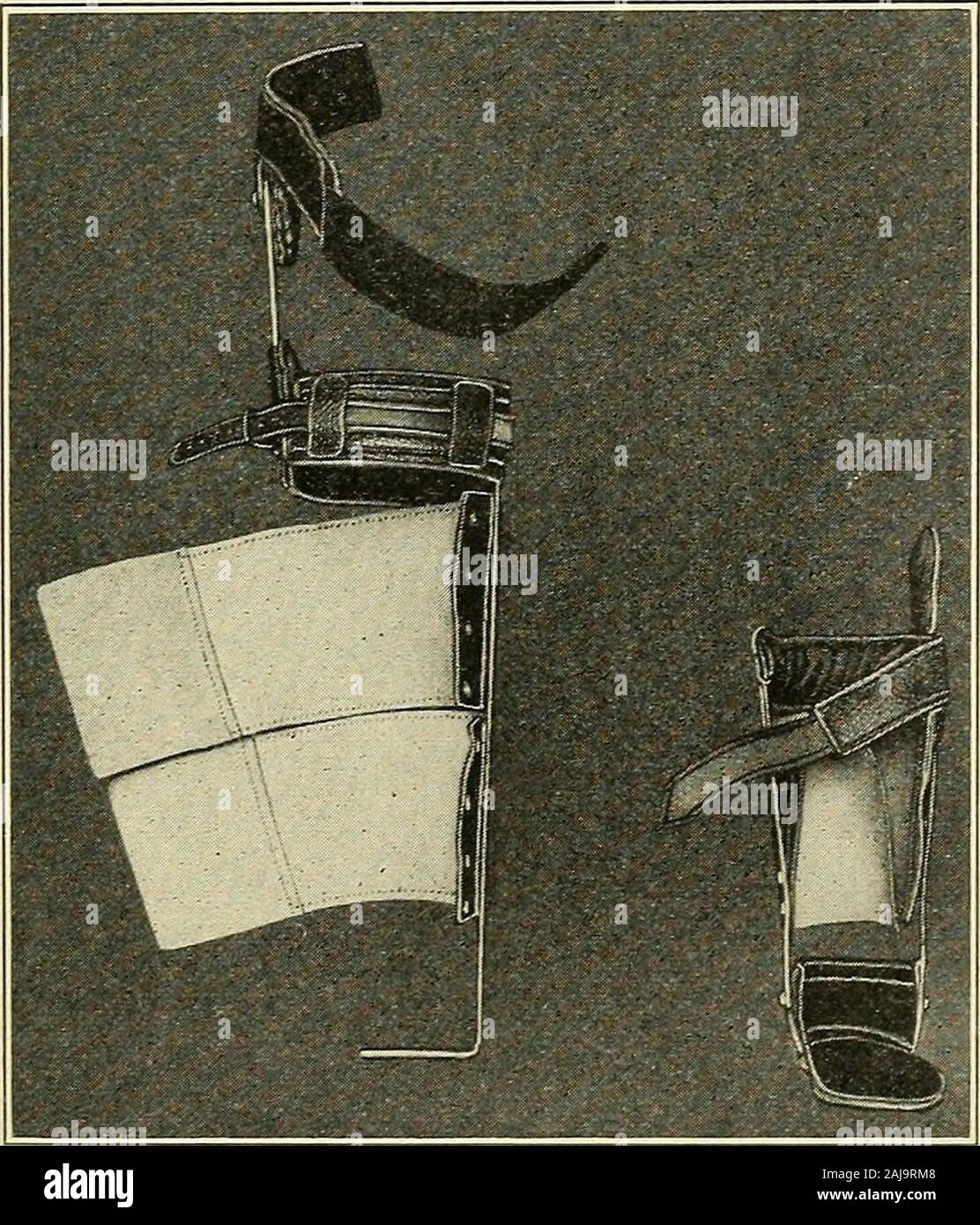 A treatise on orthopedic surgery . Long braces for genu varum.(Bradford ... - Precision Contour Lacing For Foot Positioning