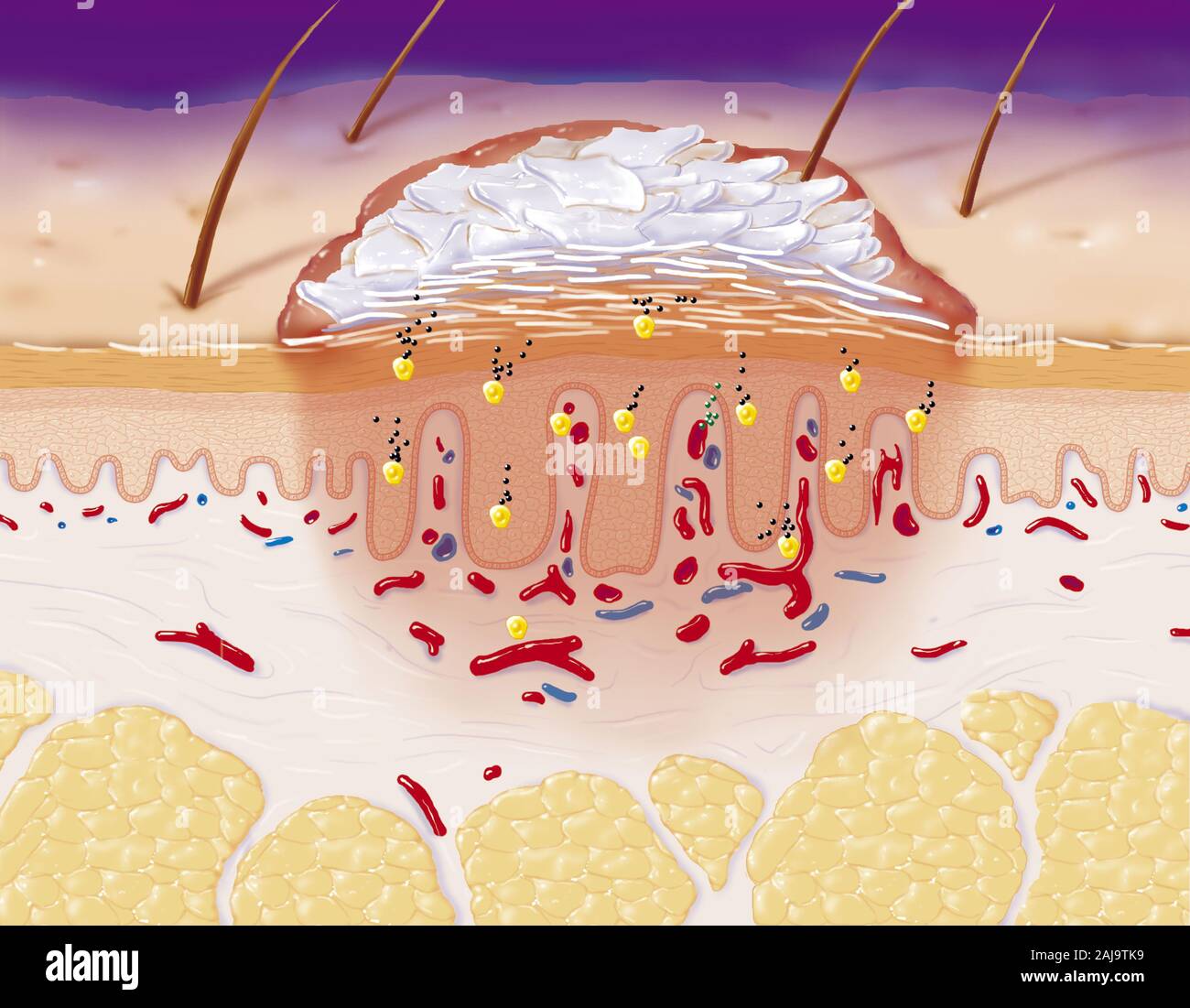 Subcutaneous tissues hi-res stock photography and images - Alamy