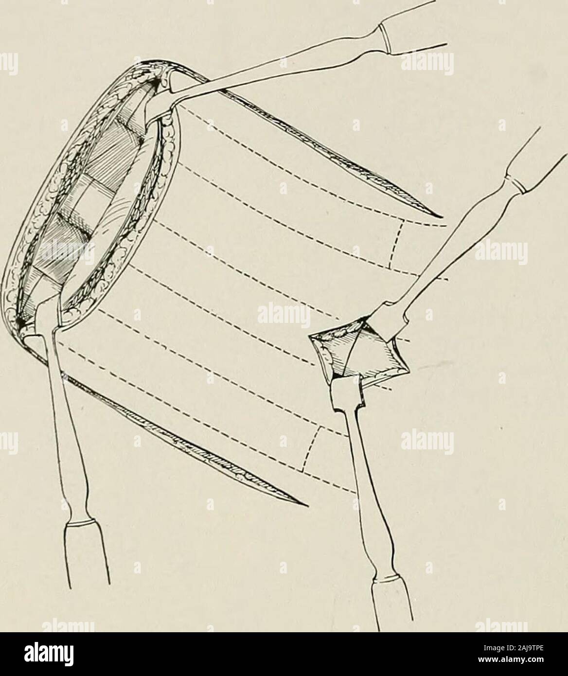 Surgical treatment; a practical treatise on the therapy of surgical diseases for the use of practitioners and students of surgery . this flap, the ribs may be broken. It is better to cut with forceps thetwo ribs adjacent to the incision and then divide the intervening rib or ribs through a smallincision at the base of the flap. 456 5 URGICAL TREA TMEN T For exposing the apex of the lung a U-shaped flap is made having itsconvexity at the border of the sternum, its base at the anterior axillary line,its upper arm at the first intercostal space, and its lower arm in the thirdintercostal space. If Stock Photo