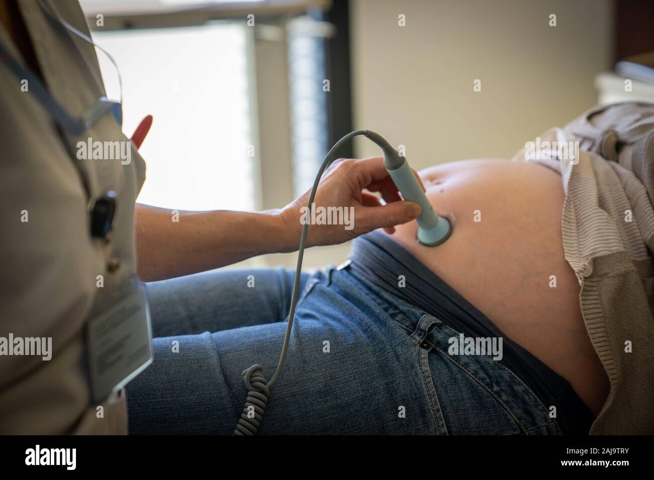 Acupuncture pour femmes enceintes Stock Photo