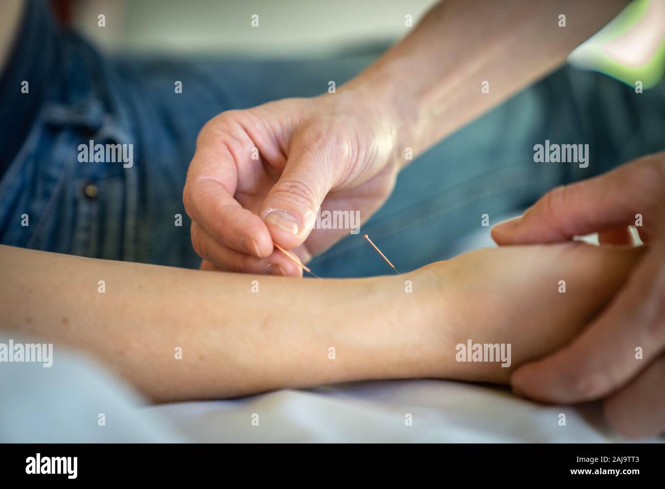 Acupuncture pour femmes enceintes Stock Photo