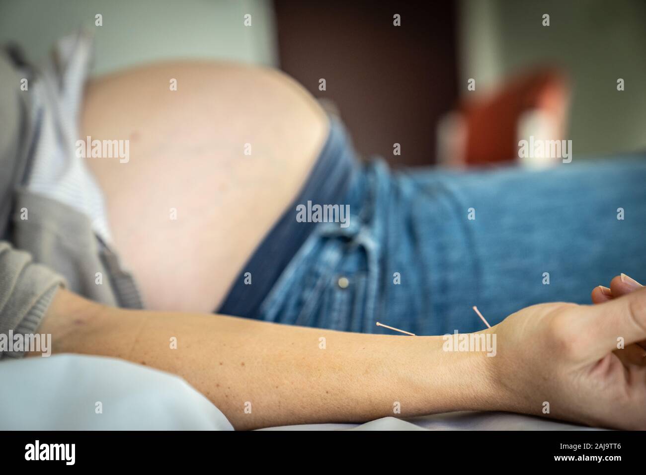 Acupuncture pour femmes enceintes Stock Photo