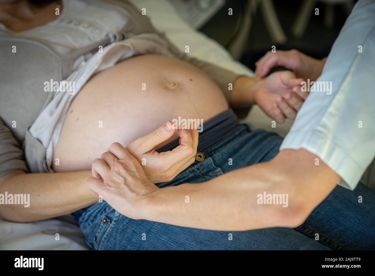 Acupuncture pour femmes enceintes Stock Photo