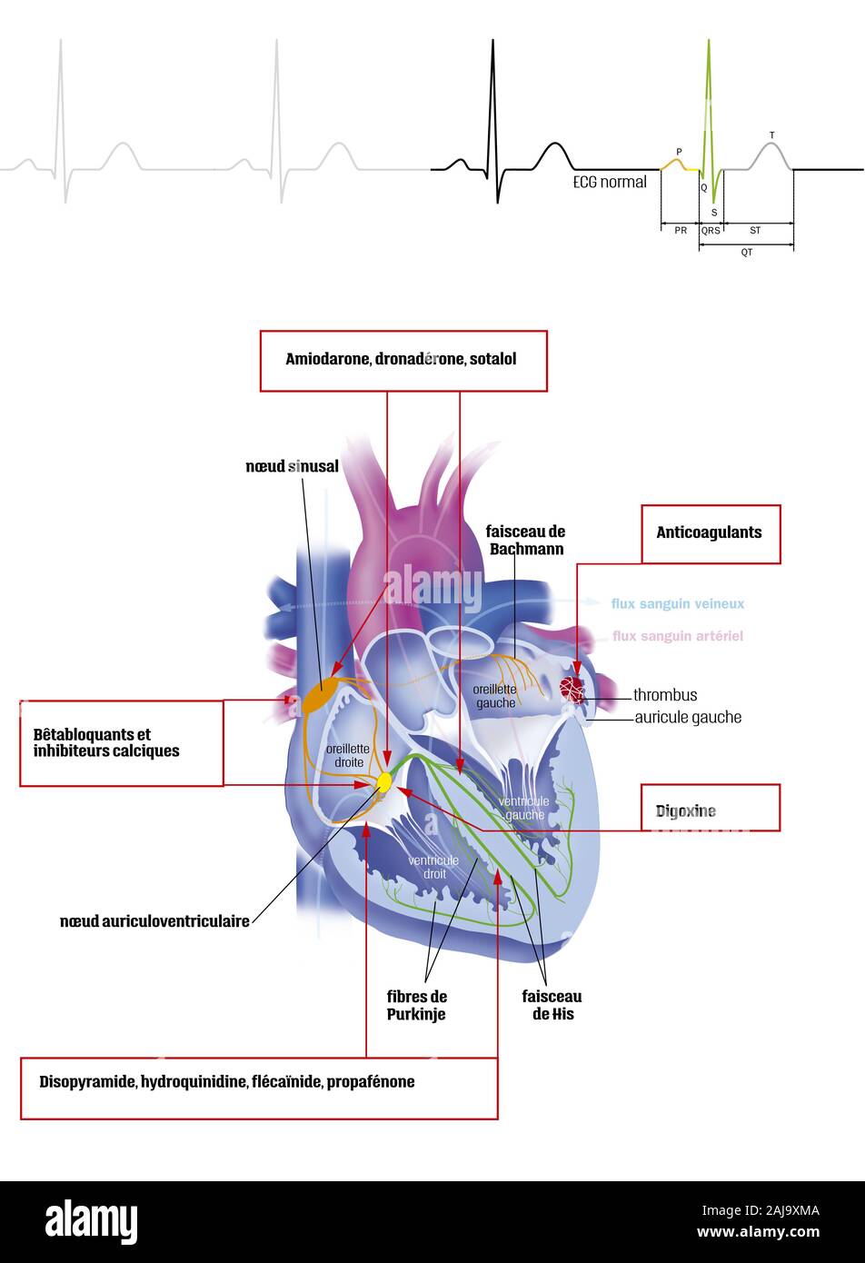 Atrial fibrillation and treatments Stock Photo