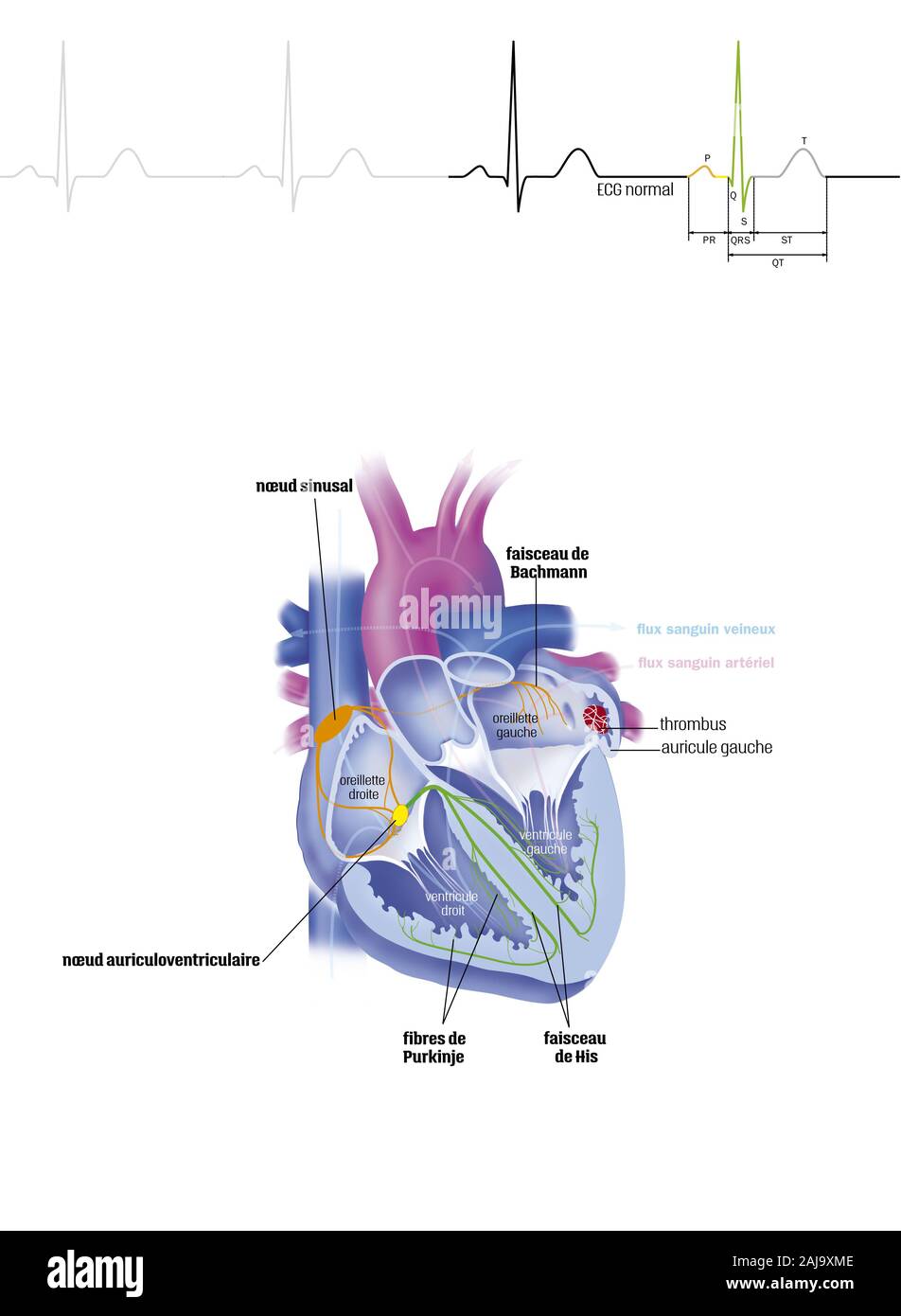 Atrial fibrillation Stock Photo