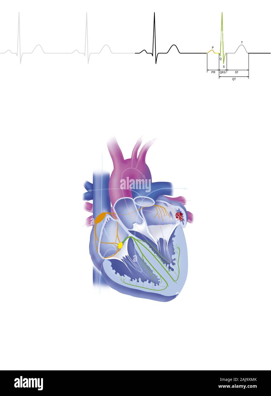 Atrial fibrillation Stock Photo