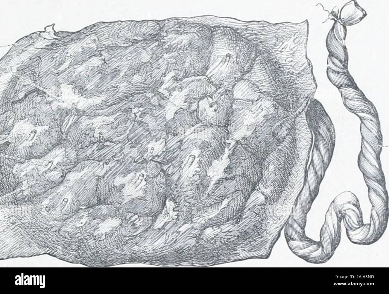 An atlas of human anatomy for students and physicians . Amnion (folded backover the placenta) Fig. 892.—Internal or Fcetal Surface of the Placenta m: Full Tlrm. The umbilical vessels have been injected. Decidua serotina Membrana decidua (basalis)- Tom uterine (utero-placental) veins Cotyledons, lobes, or loculi of the placenta Lobi placental. Umbilical cord -Funiculus umbilicalis Fig. 893.—External, M.vternal, or Uterine Surface of the Placenta at Full Term, with the Umbilical Cord (Funiculus Umbilicalis). Branches of the umbilicalartery in cross-section Opening of a uterine (uteroplacental)ar Stock Photo
