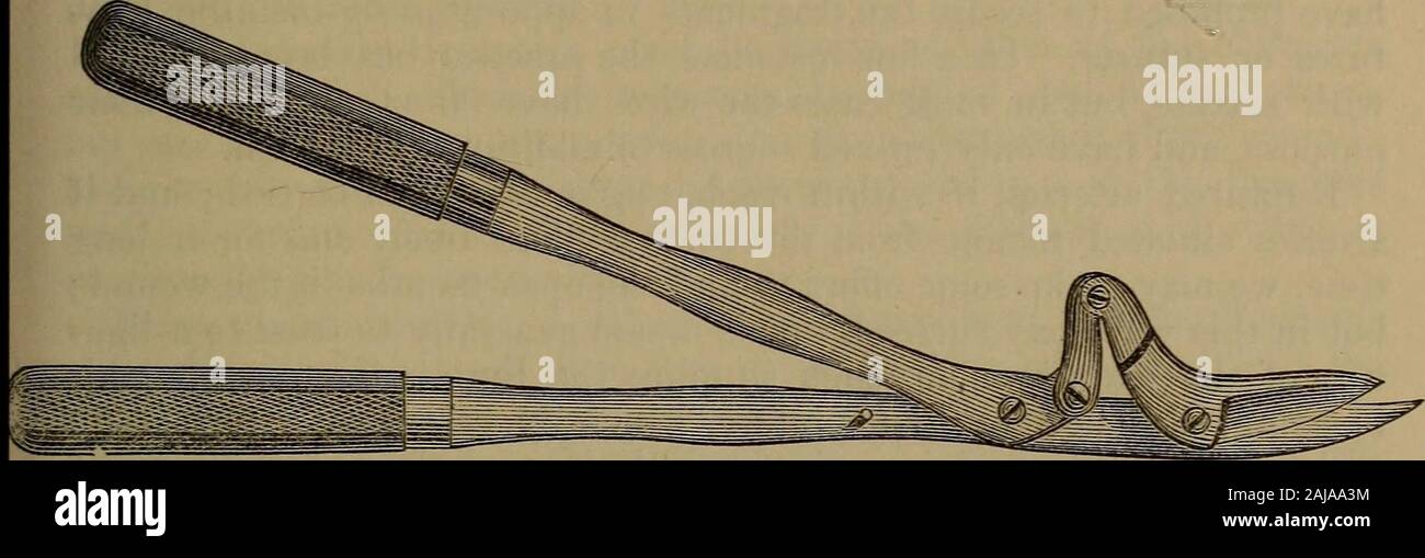 A practical treatise on fractures and dislocations . plaster we generally employ a shoemakers knife,softening the plaster as we proceed, with a sponge dipped in hot water.As cutting pliers for this purpose, no instrument has been found suf-ficiently powerful except that introduced by Dr. Victor von Brun, ofTubingen. Professor B. W. Dudley, of Lexington Ky., one of the most success-ful surgeons in this country, but especially distinguished as a lithoto-mist, for many years employed in the treatment of fractures nothingbut a roller, regarding both side-splints and extending apparatus as 1 Weber Stock Photo