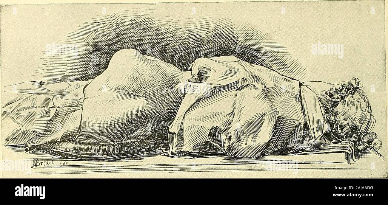 Operative gynecology . 92 THE GYNECOLOGICAL EXAMINATION.. j?IG 55