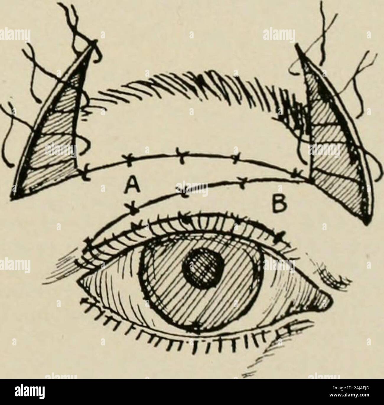Old Reverse Question Mark Incision Incisions mark hi-res stock photography and images - Alamy