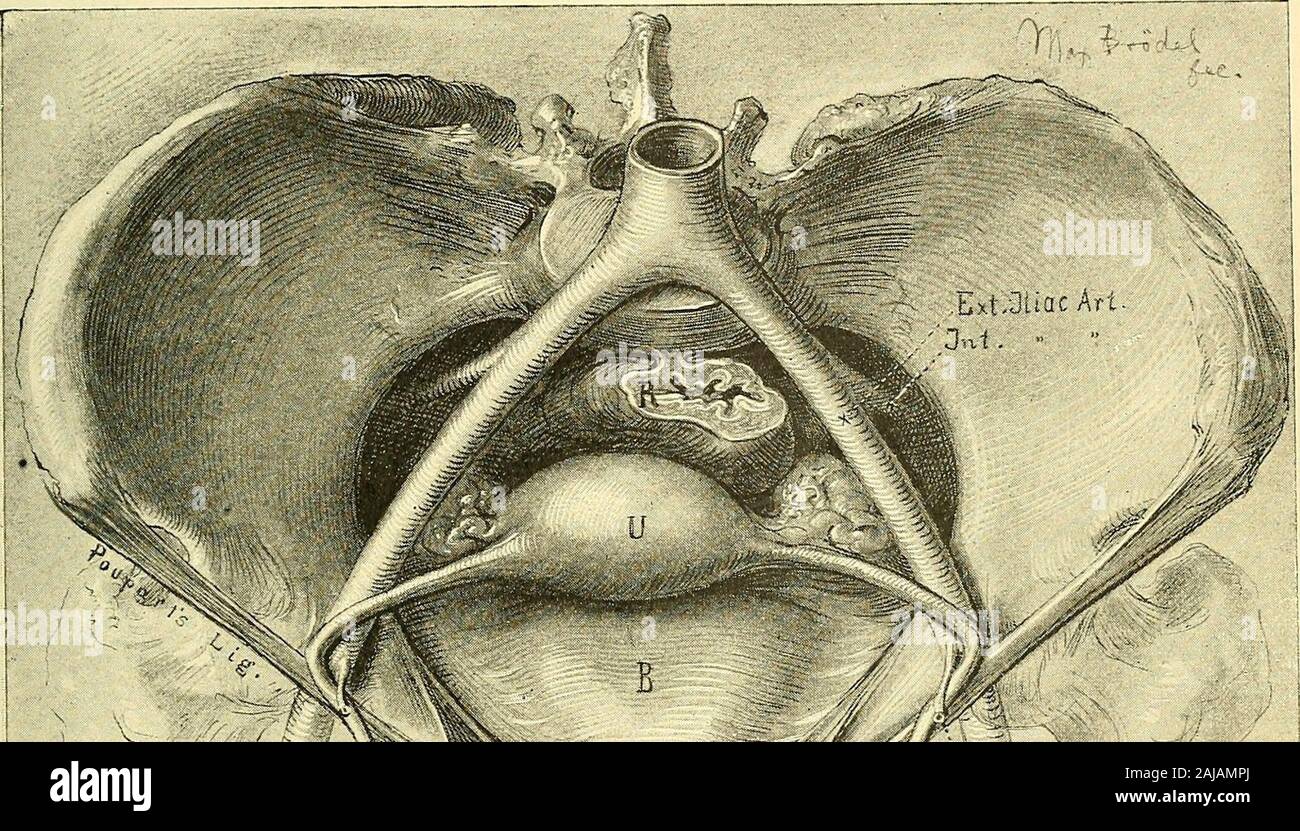 Round Ligament Inguinal Canal