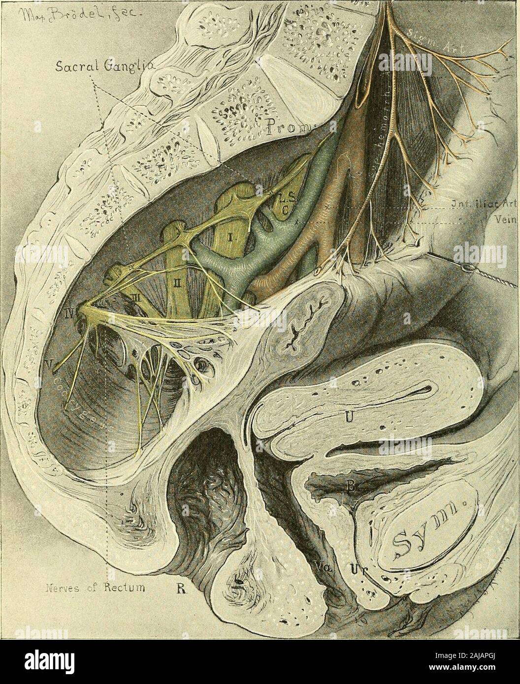 Operative gynecology : . Fig. 37.—The Topography of the Fixed Part of the Bladder. The Vesical Cornua lie to theRight and Left of the Ureteral Orifices, Just in Front of the Broad Ligaments. sacral and lateral pelvic regions. The distribution of the superior hemor-rhoidal vessels is also seen. The sacral plexus of nerves is seen to emergefrom the sacral foramina, forming the lumbo-sacral cord, and the first, second, 72 TOPOGRAPHICAL ANATOMY. third, fourth, and fifth sacral cords, which converge toward the great sacro-sciatic foramen, to unite in the sciatic nerve. The sacral ganglia of the. Fi Stock Photo
