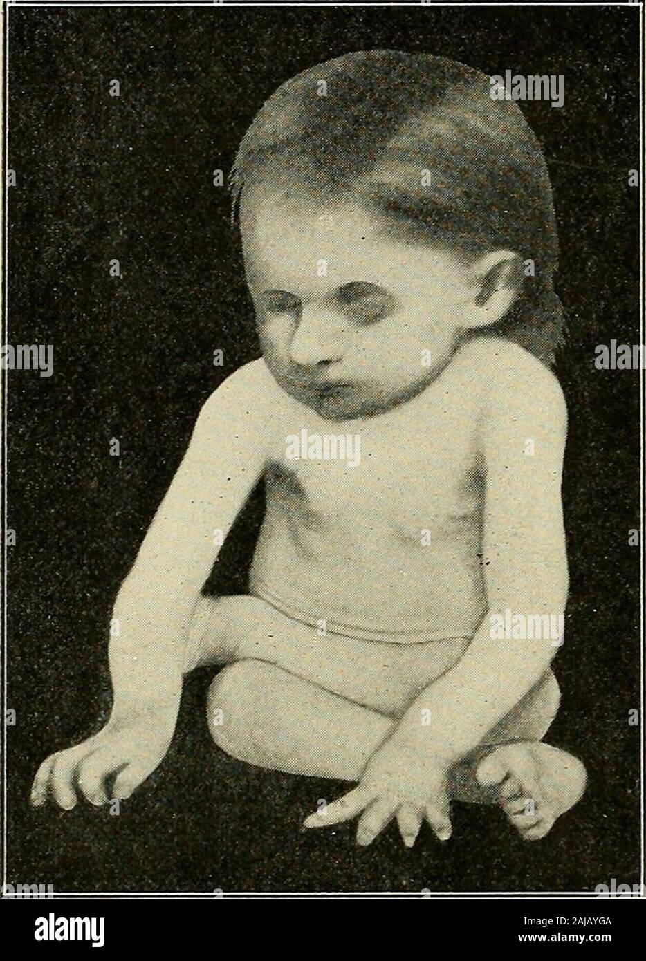 Two clavicles hires stock photography and images Alamy