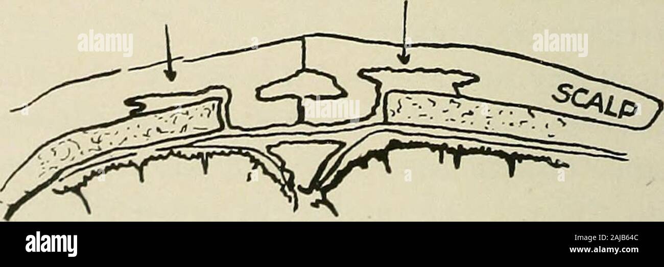 surgery hires stock photography and images Alamy