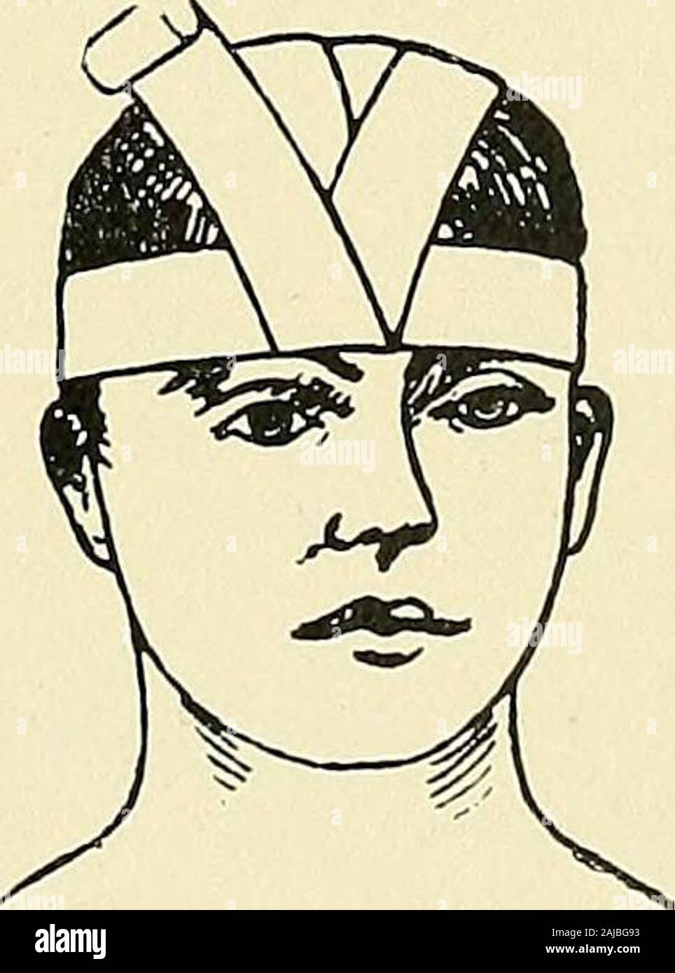 Head bandaging cheap